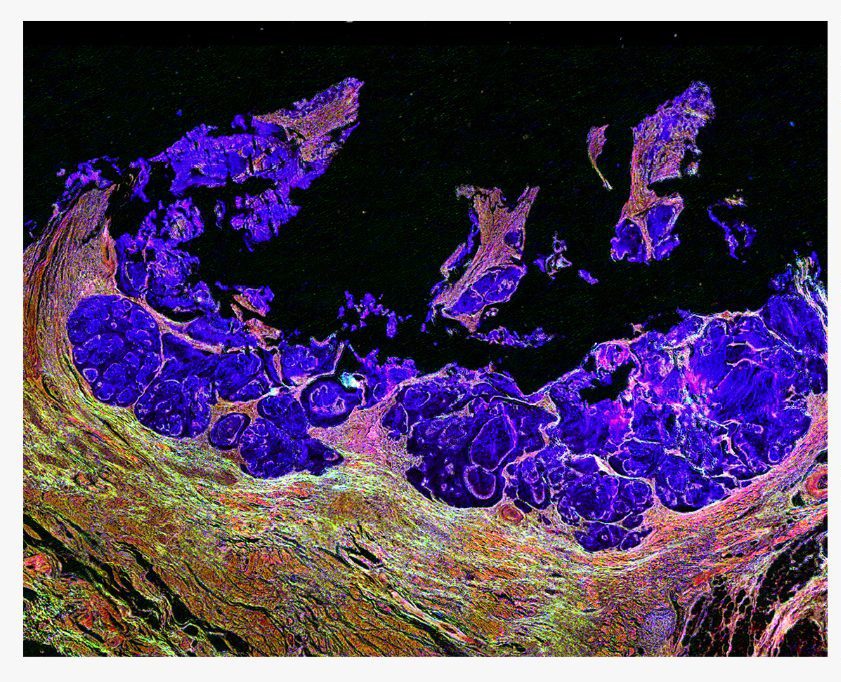 19 Giugno | Infrared Microscopy with Quantum Cascade Laser for Biomedical Applications